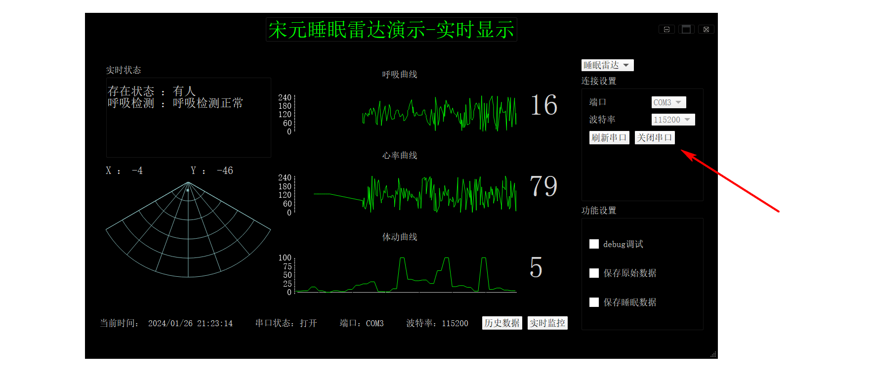 基于STM32+微波雷达设计的非接触式睡眠监控系统-鸿蒙开发者社区